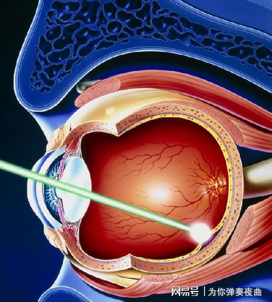 深圳近视眼激光手术，现代医学的奇迹与未来视力的希望  深圳近视眼激光